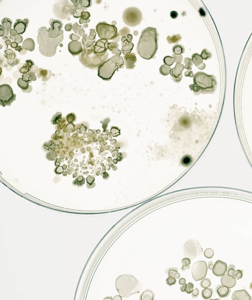 A close-up of two petri dishes displaying various bacteria, including nontuberculous mycobacteria and other waterborne pathogens.