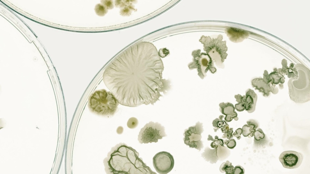 A close-up of a petri dish displaying various bacteria, including nontuberculous mycobacteria and other waterborne pathogens.